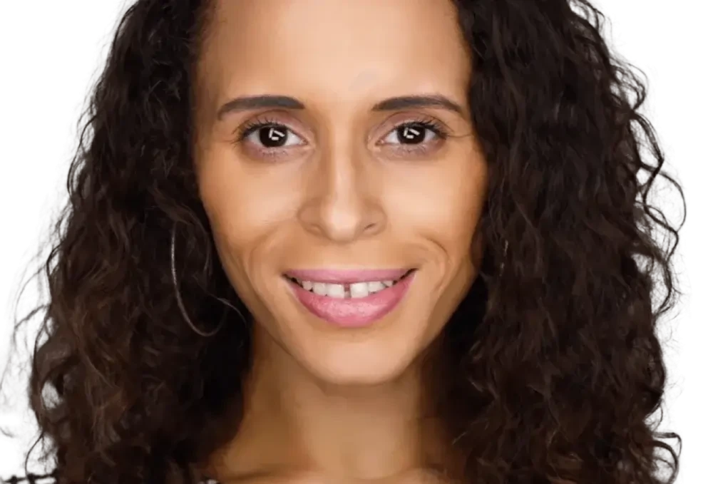 Natalie Ambersley, Speaker | Self-Confidence, Vitiligo Ambassador