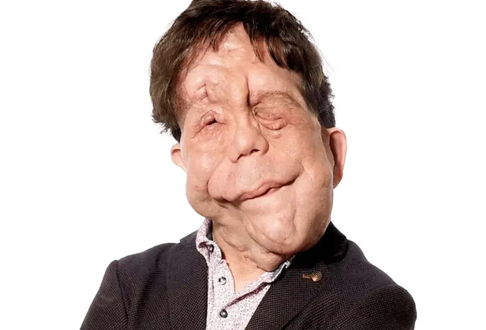 Adam Pearson