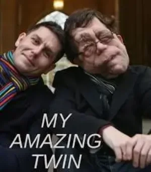 Adam Pearson - My Amazing Twin book cover
